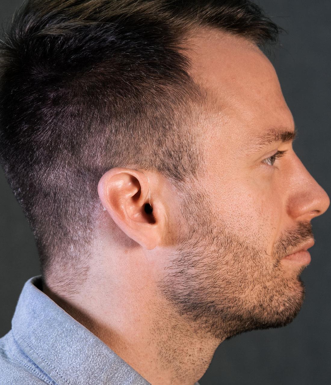 man wearing a receiver-in-Ear (RIE) style hearing aid