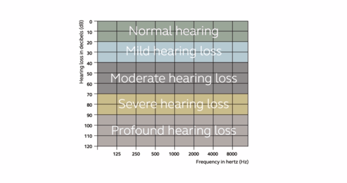 Levels of hearing loss video thumbnail.
