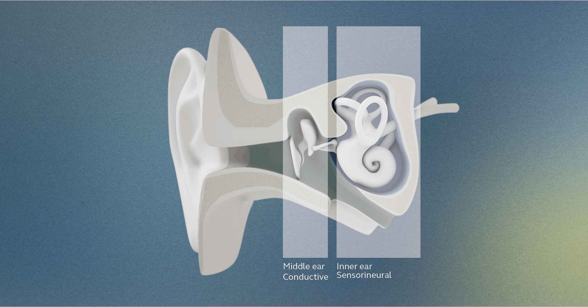 Anatomy of the ear and levels of hearing loss.