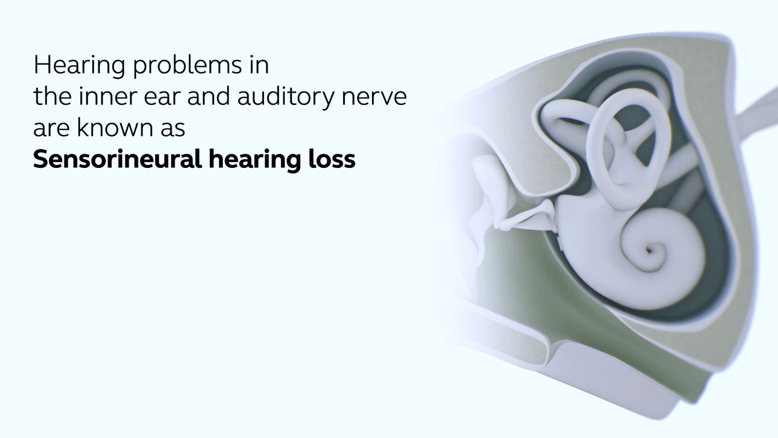 Video thumnail: hearing loss.
